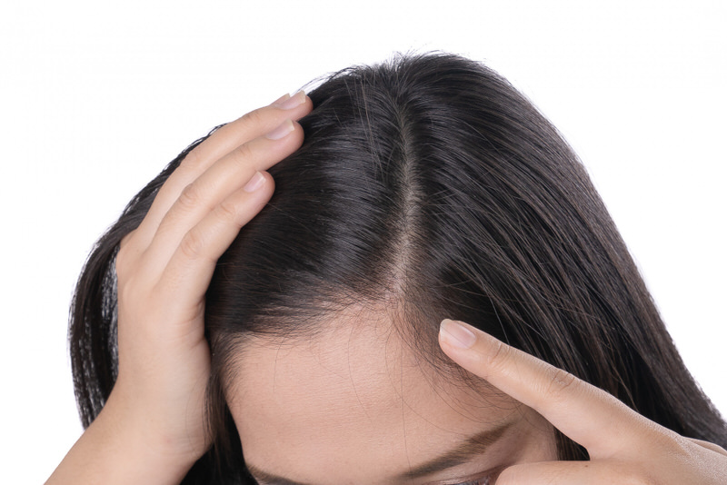 A woman is showing her healthy scalp, a benefit after using Reishi mushrooms for hair health.