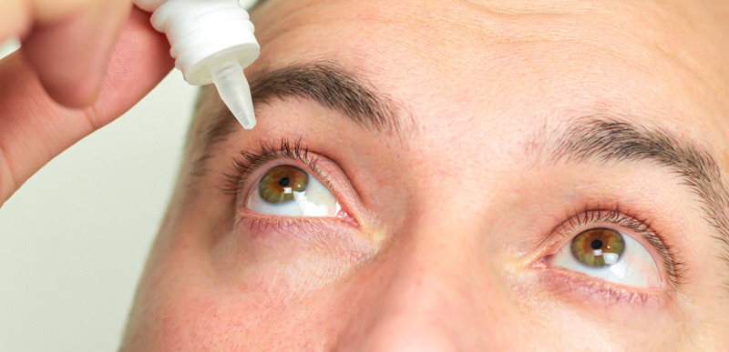 A man is putting eye drops into his eyes to relieve any allergies and to help stop his eyes from pulsating.