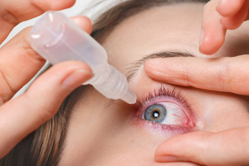 A young girl is putting eye drops in her eye to help get an eyelash out from behind her eye.