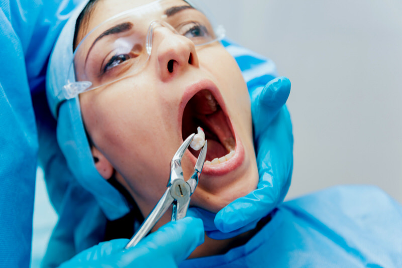 A woman is at the dentist getting one of her molar teeth extracted.
