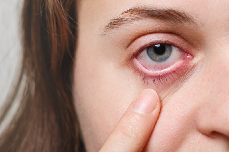 What Happens When An Eyelash Goes Behind Your Eye (And Other Foreign Objects)