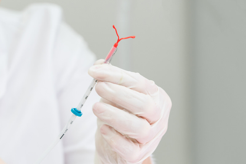 A gynecologist is holding an IUD to place it inside her patient's vagina.
