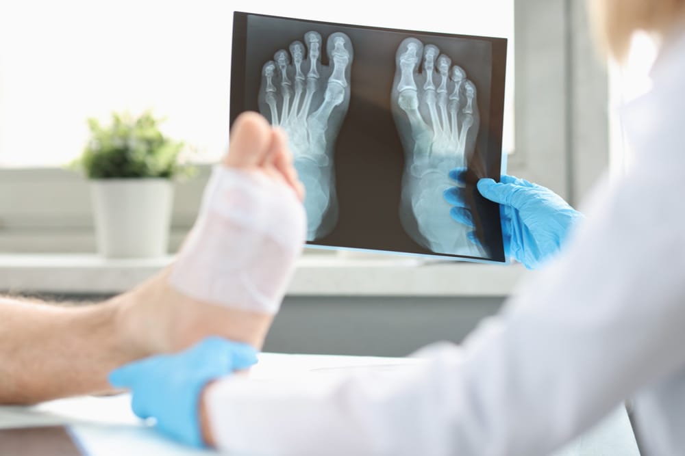 A podiatrist is looking at his patients foot after bunion surgery to see if a revision surgery is required