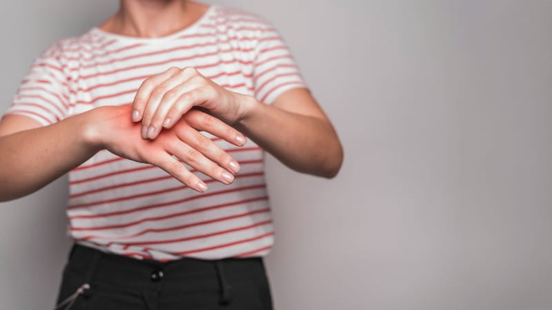 A woman is holding her hand in pain because of her arthritis