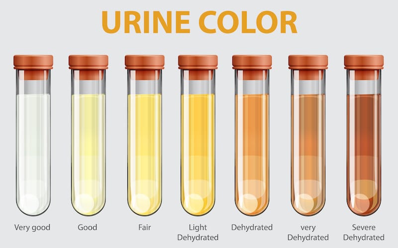 A urine color chart with 7 different stages of dehydration based on urine color
