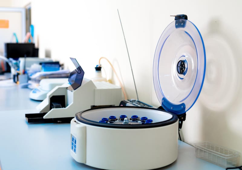 An electronic centrifuge to be used for microscopic urine analysis