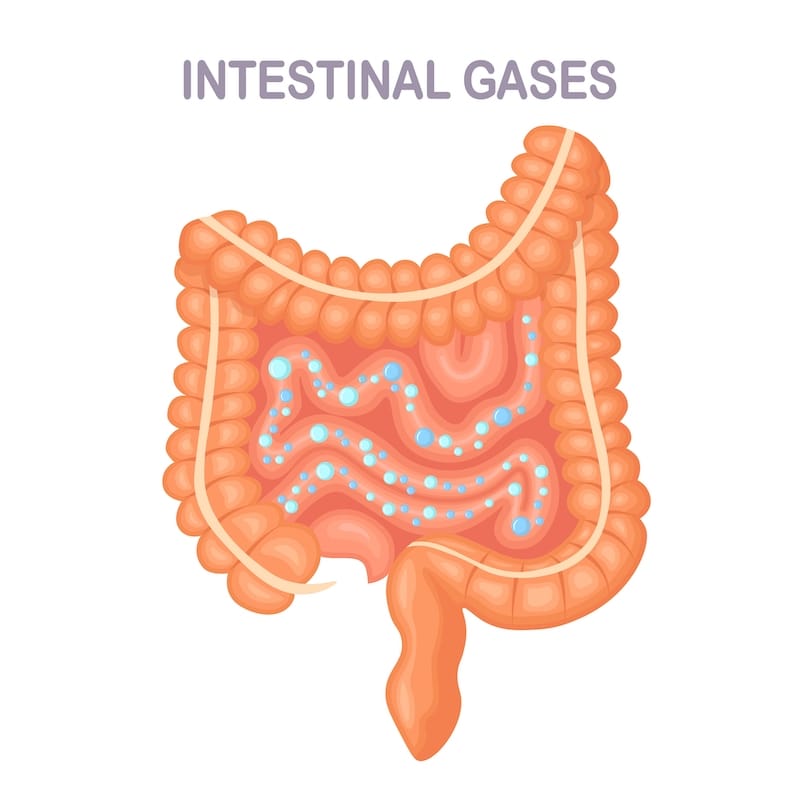 A graphic showing the intestine with bubbles inside it, created by gassy foods, causing discomfort and other symptoms.