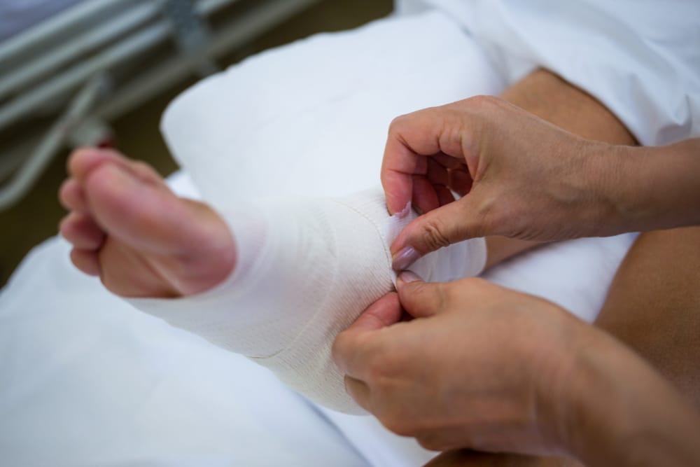 A patient is getting a bandage placed on his leg after his recent bunion surgery