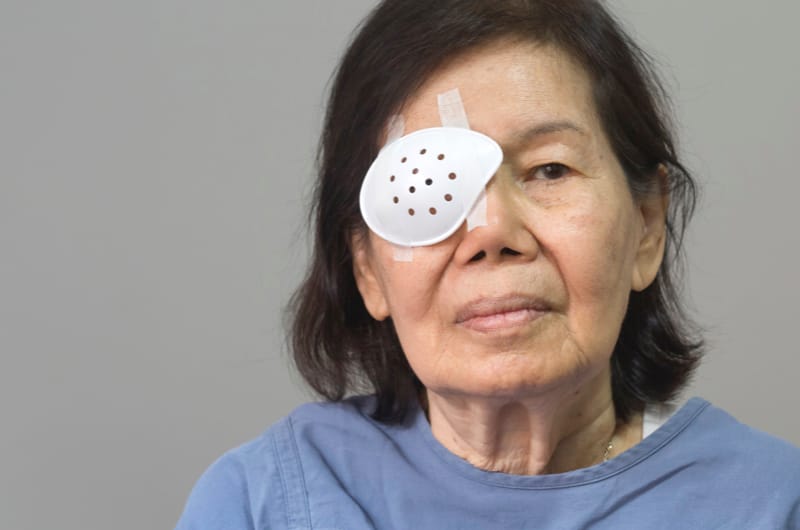 Showering And Washing Hair After Cataract Surgery - Do's & Don'ts You Need To Know