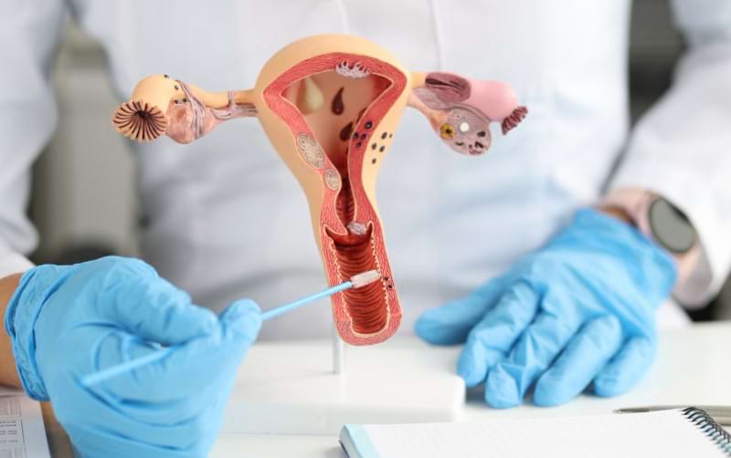 A gynecologist shows the female reproductive system and tells how a Pap test is performed.
