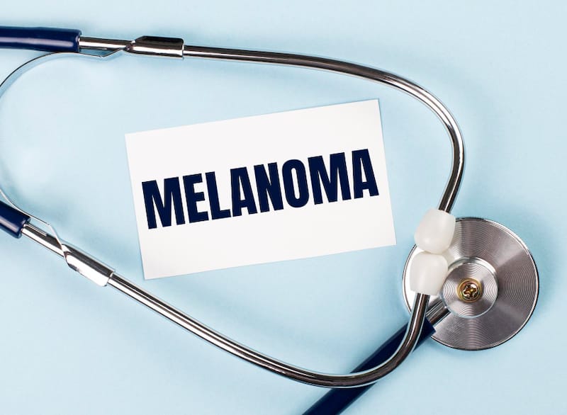A stethoscope with a paper that says Melanoma